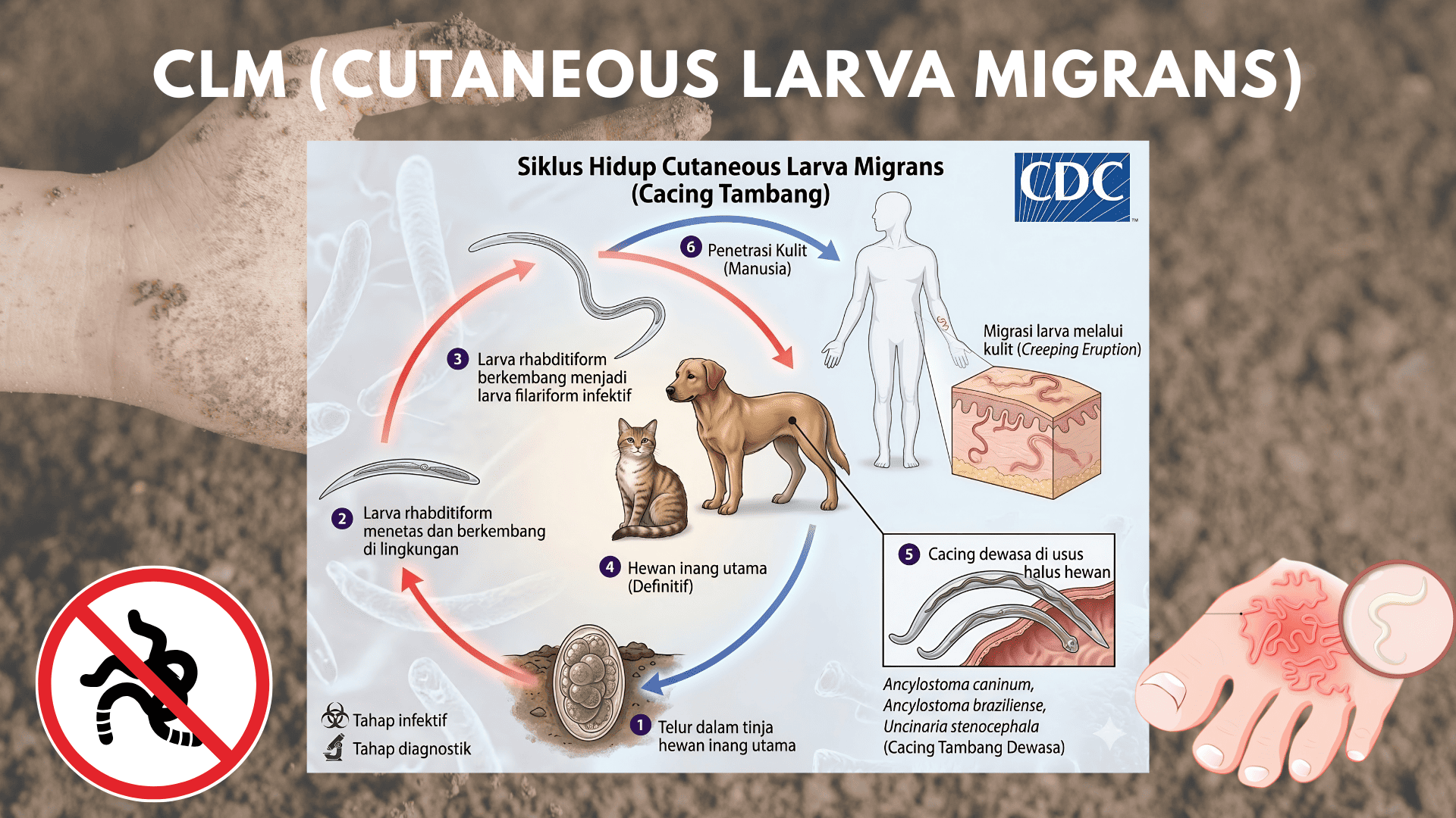 Cacing Nyasar di Bawah Kulit. Waspada CLM!